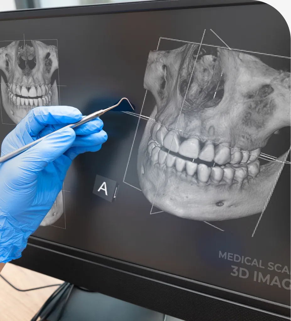 3D Cone Beam Imaging in Exton, PA: Clear 3D Dental Views - Comfort Dental Care